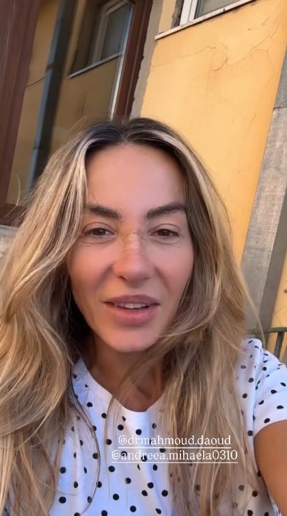 Flavia Mihășan după operația la nas