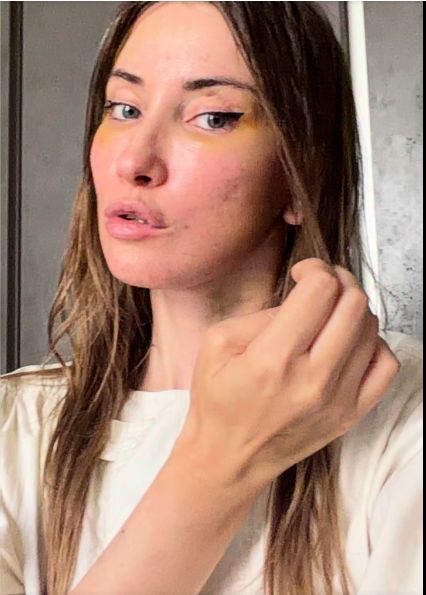 Iulia Albu, sinceră despre intervențiile estetice: „Mi-am dorit un deep plane facelift. Fără filtre, fără vrăjeală”