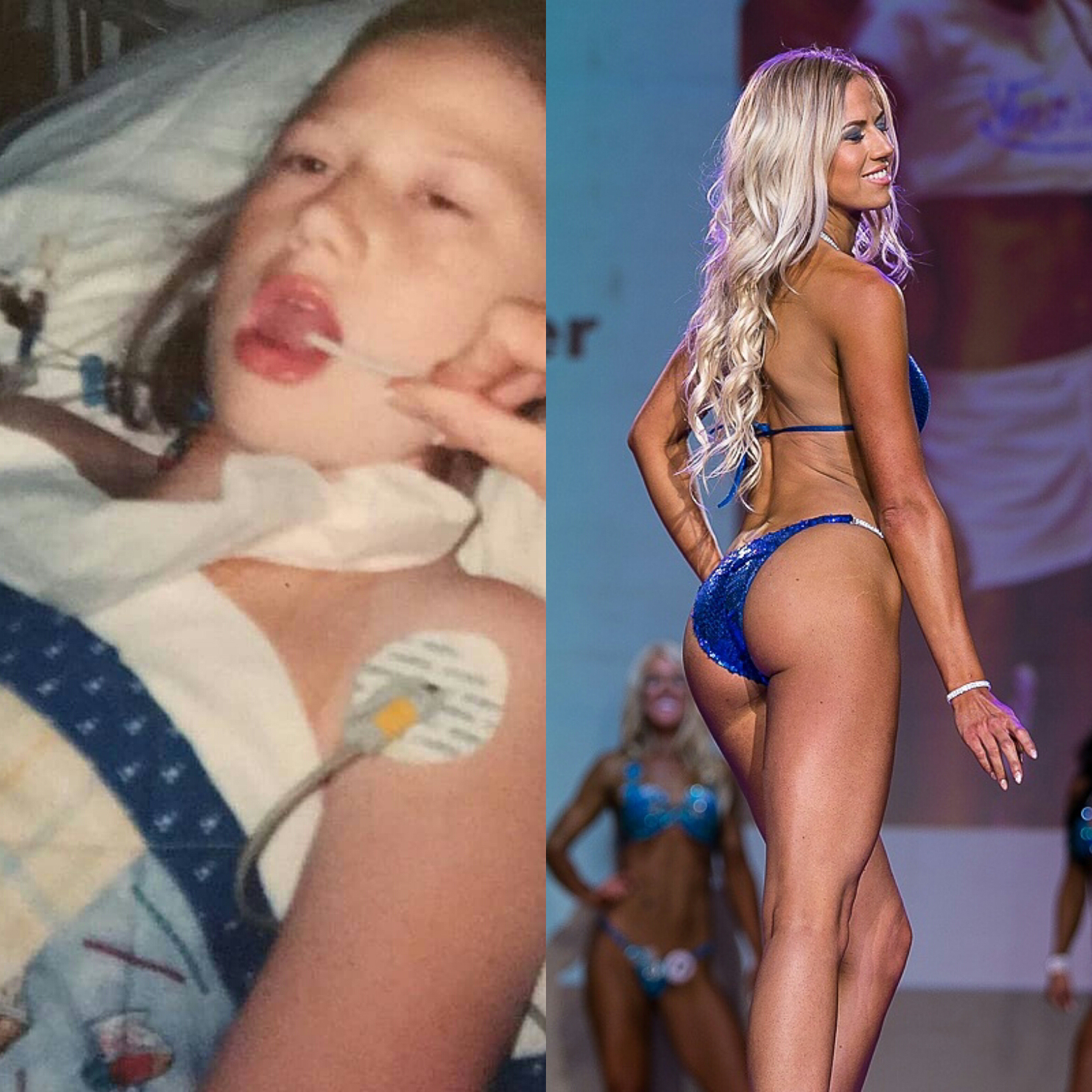 FOTO | Povestea culturistei care a fost de doi ori în moarte clinică și a avut patru operații pe cord