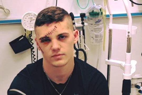 FOTO | Un tânăr a fost mutilat de o gașcă de huligani. Mesajul uluitor, devenit viral, către cei care l-au desfigurat