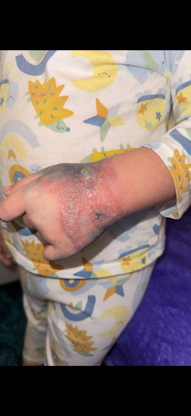 Un copil de doi ani a fost ținut patru zile cu branula neschimbată, la Spitalul de Urgenţă Râmnicu Vâlcea