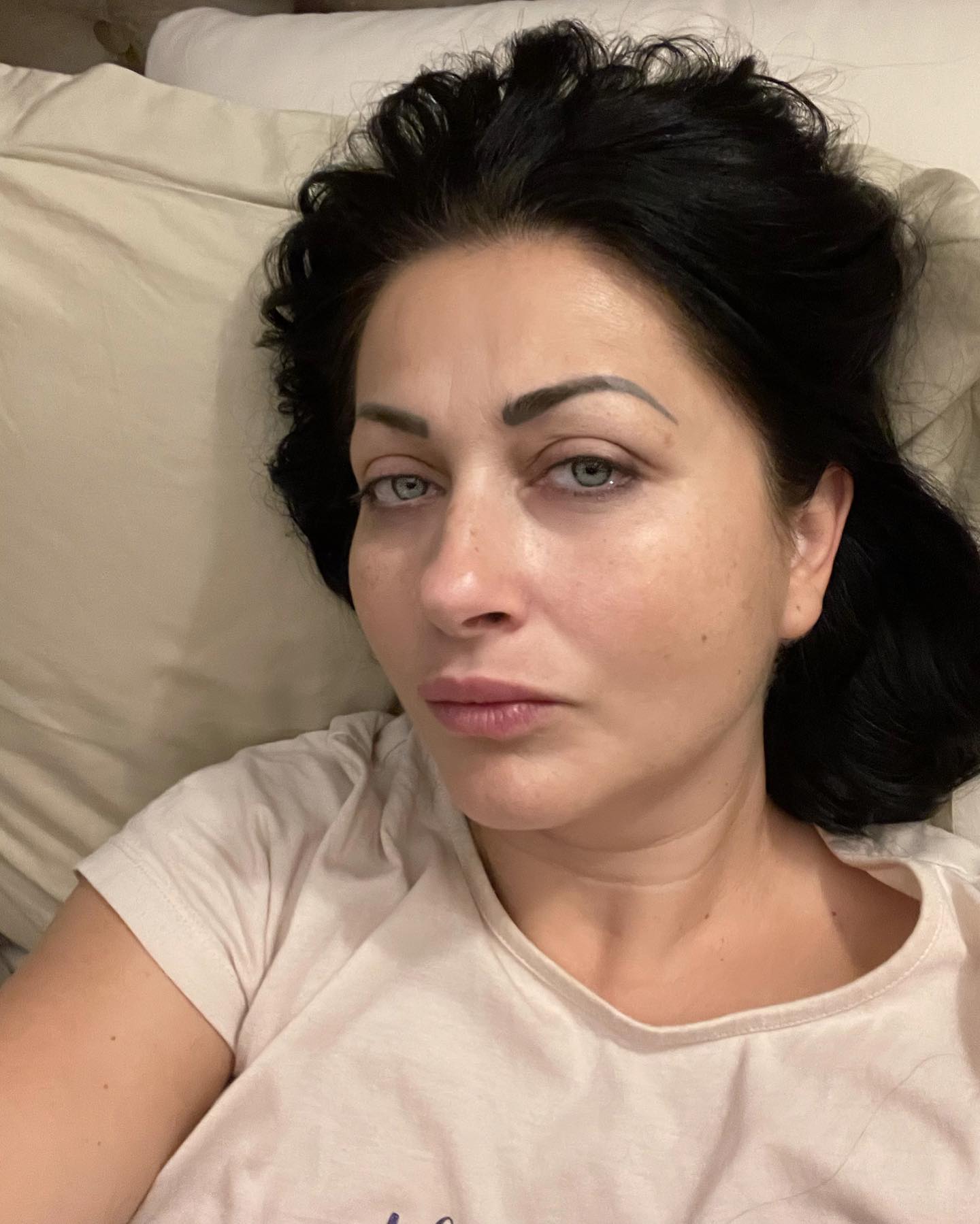 Gabriela Cristea și-a făcut terapie cu laser la față. Ce problemă a vrut să rezolve după cele două sarcini