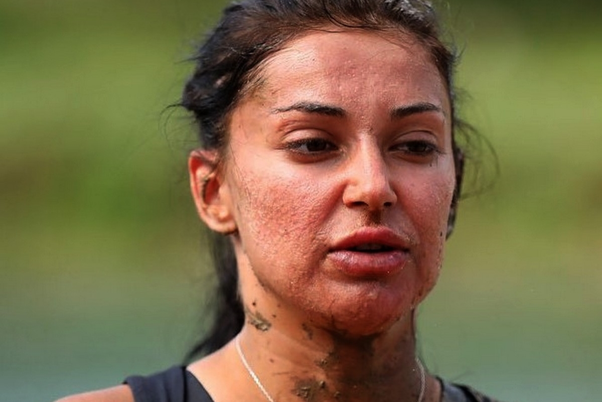 Ce a pățit Elena Ionescu după ce s-a machiat. Artista urmează acum tratament antibiotic: „Nu e tocmai confortabilă treaba”