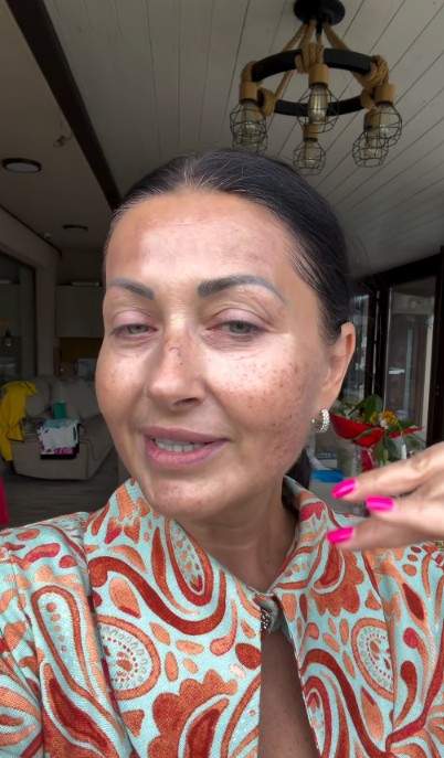 Gabriela Cristea și-a făcut terapie cu laser la față. Ce problemă a vrut să rezolve după cele două sarcini