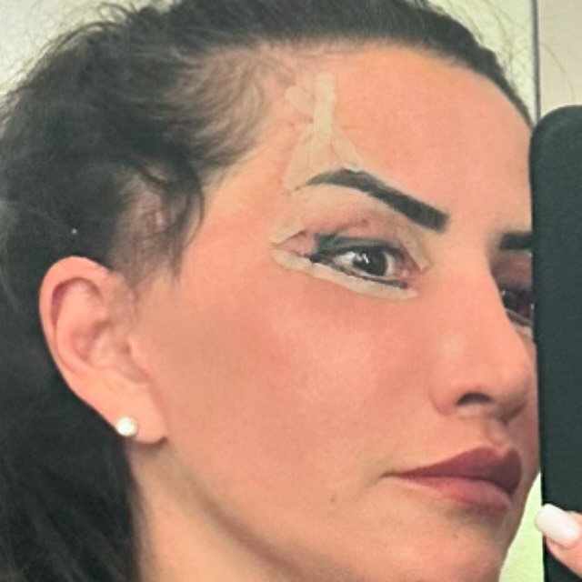 Mara Bănică, o nouă intervenție estetică la față: „A durat o oră și jumătate și a costat 3.200 de euro”. Ce procedură și-a făcut