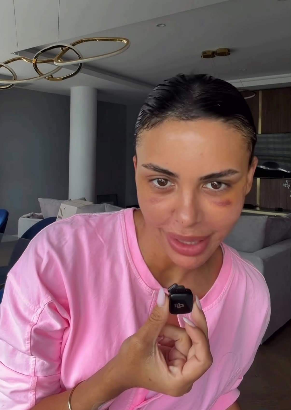 Imagini cu Andreea Popescu după intervențiile estetice. Ce a schimbat vedeta la ea. „Mi-a căzut părul. Pielea a arătat horror”