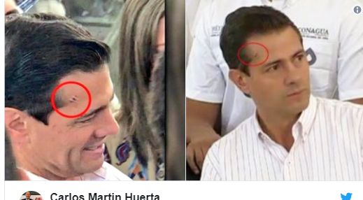 Președintele mexican a apărut în public cu o rană la cap. Ce i s-a întâmplat | FOTO