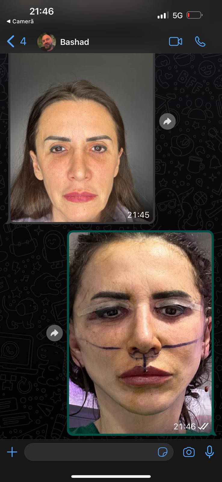 Cum arăta Mara Bănică înainte de liftingul facial. Motivul pentru care a apelat la medicul estetician: „Nu mi-a fost rușine cu cine sunt”