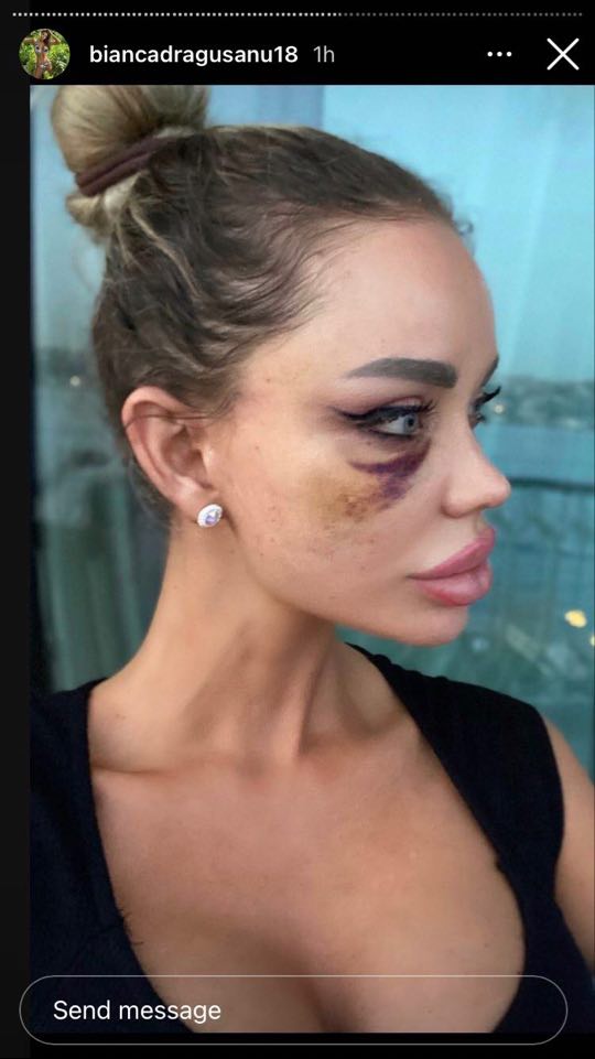 Vedete din România care au fost victime ale violenței domestice