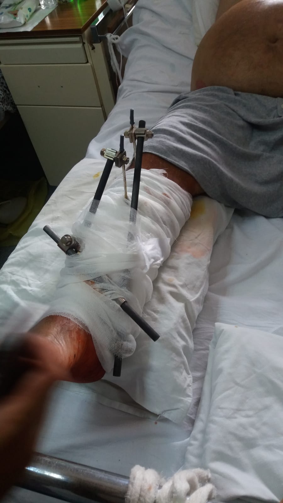 Avocații bătăușului din clanul Chira, care i-a tăiat piciorul rivalului: „Așa-zisa victimă este informatorul polițiștilor și al procurorilor”!﻿