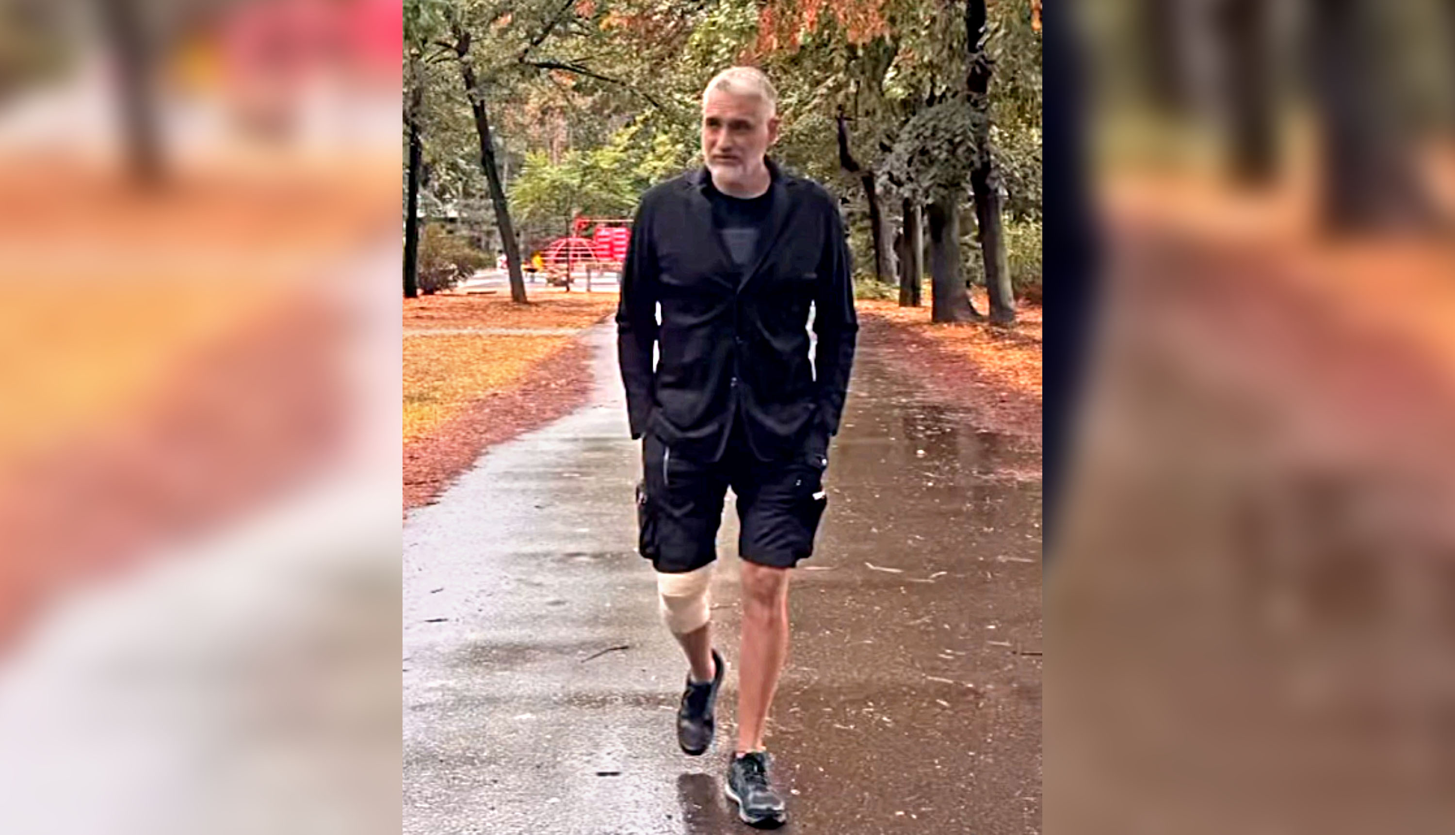 Čedomir Jovanović povređen: Političar objavio fotografiju sa zavojima na nozi