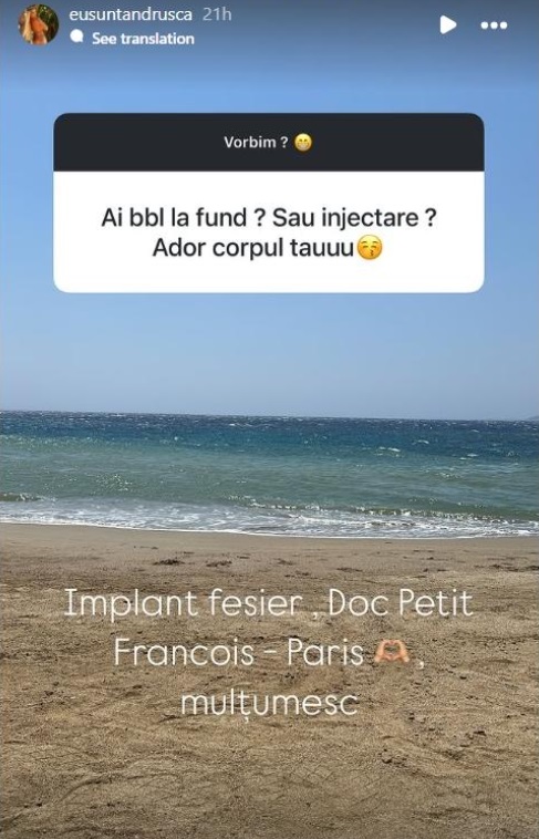 Cum arăta ispita Andreea Aurică - Andrușca de la Insula Iubirii 2025 înainte să își pună implant fesier. Operația estetică nu a făcut-o în România