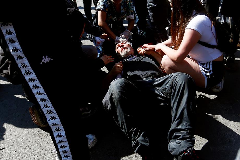 Violențe în Chile. Spitalele nu mai fac față sutelor de împușcați. Răniții sunt pe moarte din cauza lipsurilor