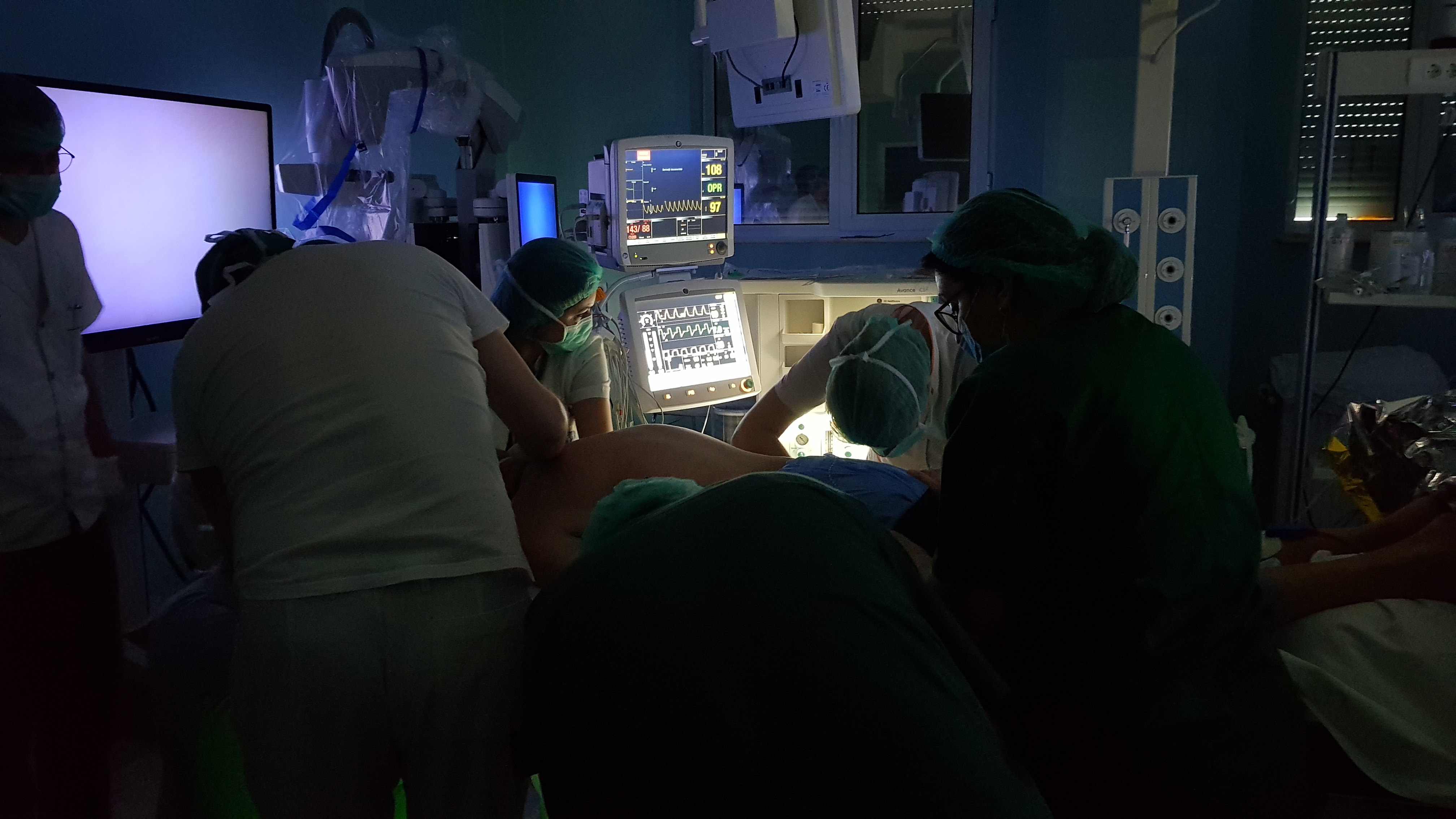 VIDEO&FOTO/ Operație pe creier cu aparatură de 1 milion de euro la Spitalul de Neurochirurgie din Iași. Medicul Lucian Eva: "Cu această aparatură intervenția devine minim invazivă"