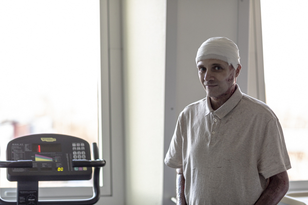 Primele imagini cu medicul-erou, după incendiul de la Piatra Neamț: „Astăzi pot să merg cu bicicleta”. Cătălin Denciu a început recuperarea