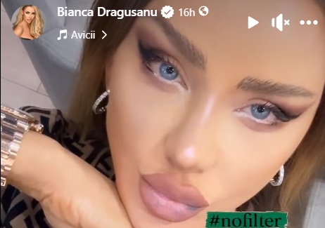Cum arată fața Biancăi Drăgușanu după operația estetică de 11.000 de euro. S-a lăsat pozată fără filtre, cu buzele învinețite