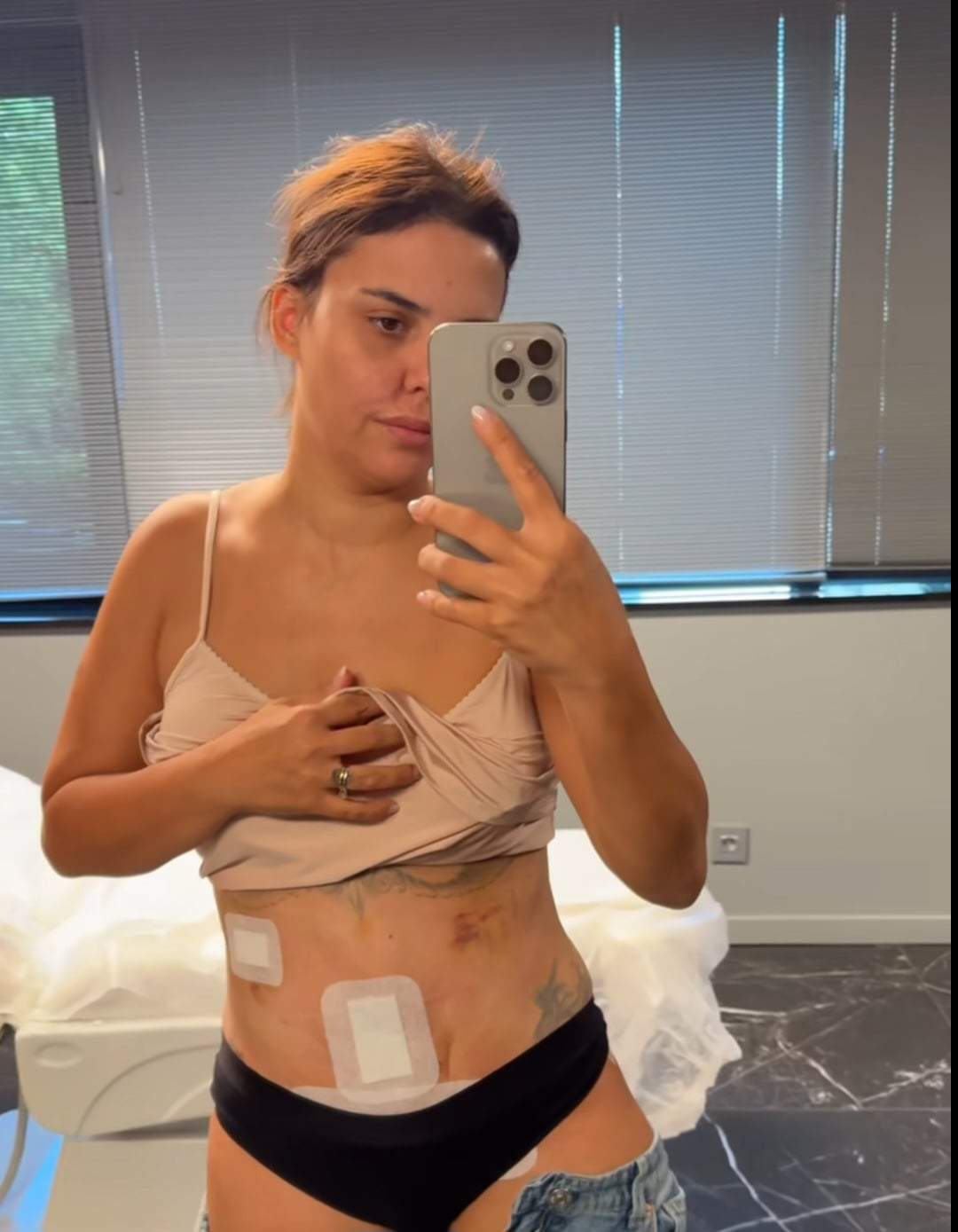 Cum arată abdomenul Andreei Popescu după intervenția de abdominoplastie. „Am venit să îmi scot bandajul”