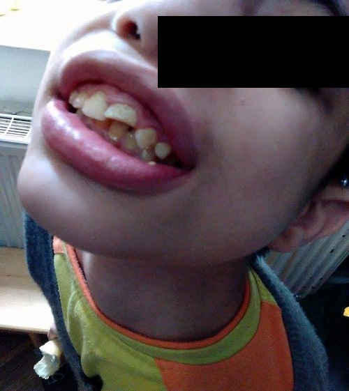 Scandalos! Copii cu dizabilități, snopiți în bătaie la centrul de plasament
