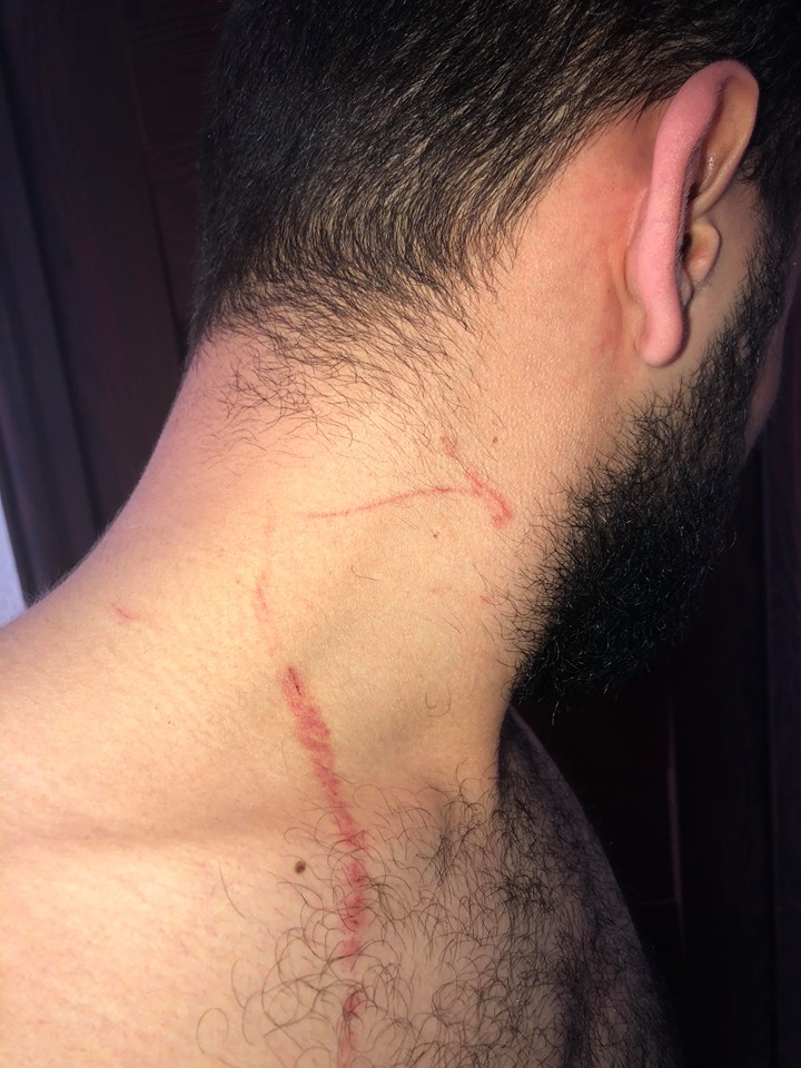 Trei ploieșteni aflați în auto-izolare la domiciliu povestesc cum au fost agresați fără motiv de polițiști. Reacția IPJ Prahova