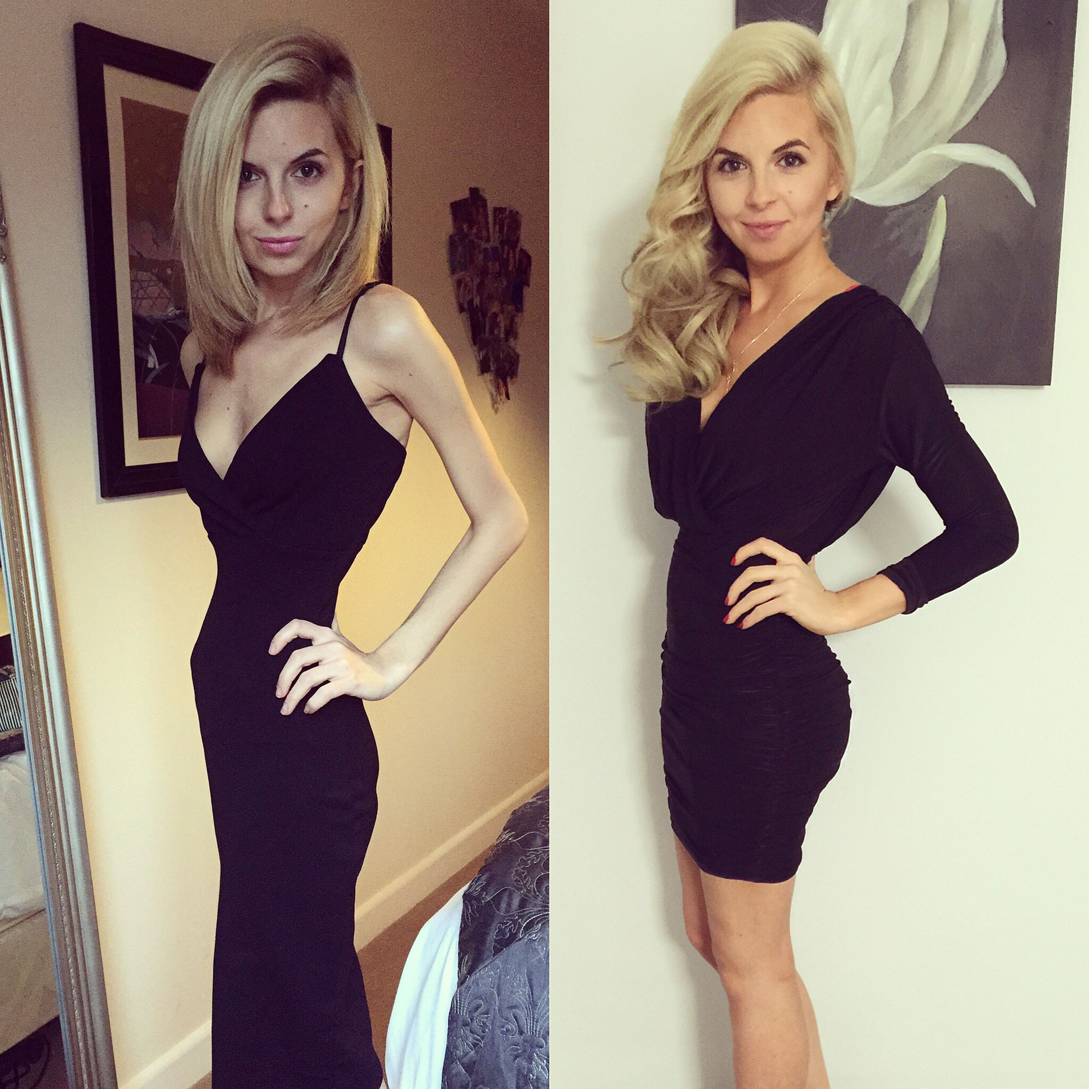 Transformare fantastică! Era anorexică și la un pas de moarte, dar acum arată incredibil. Multe vedete ar invidia-o pentru silueta ei | GALERIE FOTO