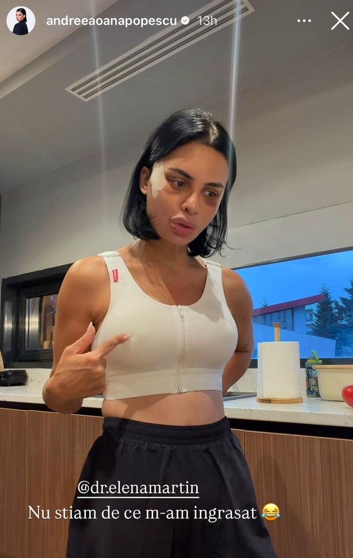 Cum arată Andreea Popescu la 7 zile de la operațiile estetice: „Sunt extrem de umflată, am capul cât o minge, sunt vânătă”