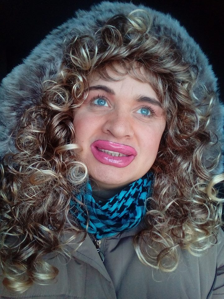 Halucinant cum poate să arate Cristi din Banat. "Mi-am pus silicon de sărbători, nu pot vorbi, nici nu pot mânca" | FOTO