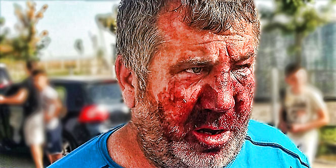 Un antrenor a fost umplut de sânge de rudele unui fotbalist. Imagini horror