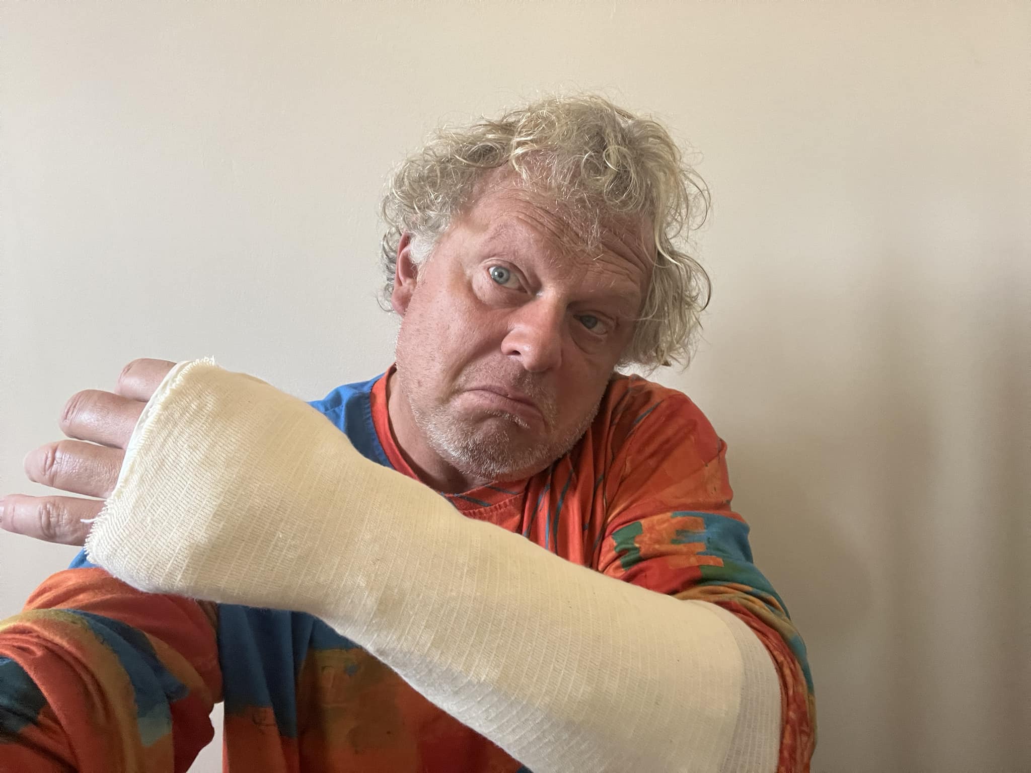 Leonard Miron a ajuns la spital cu mâna ruptă și o coastă fisurată: „M-am împiedicat și am alunecat vreo 4-5 trepte”