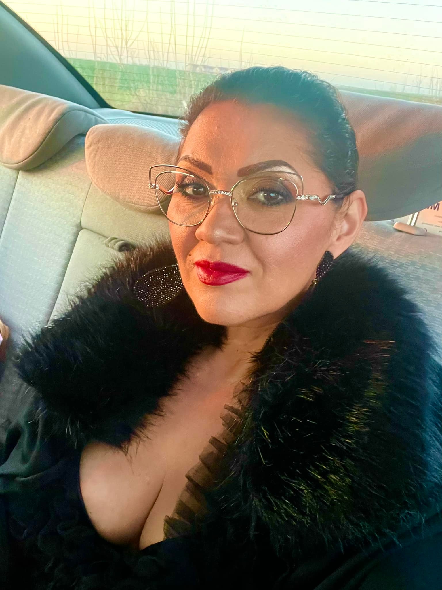 Minodora și-a făcut o nouă operație estetică: „Sunt tăiată după ureche. Totul e amorțit, doar usturime așa”. Artista nu se oprește aici cu intervențiile