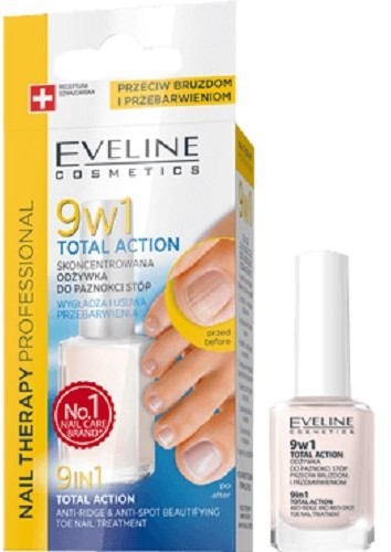 Eveline Nail Therapy, odżywka skoncentrowana do paznokci stóp 9w1, 12 ml