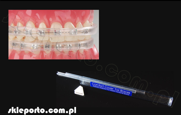 Ortho Technology Comfort Cover silikonowy ochraniacz ortodontyczny na zamki - osłona ortodontyczna 98165