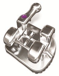 Ortho Technology Zamki ortodontyczne Pinnacle Mbt - OrthoTechnology 360-92-2011
