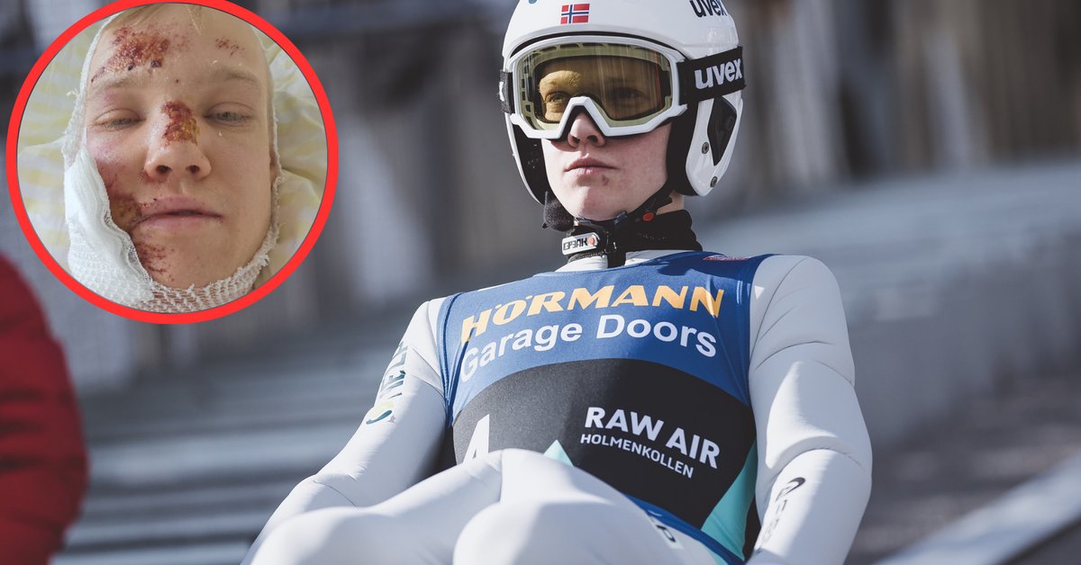Norwegian Ski Jumper Retires Due to Terrible Fall