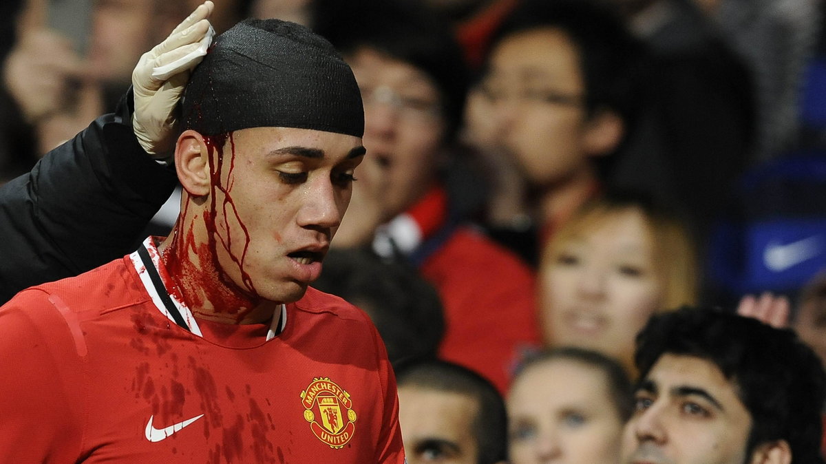 Chris Smalling