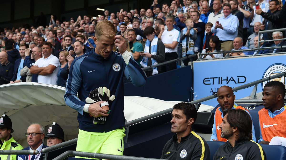 Joe hart