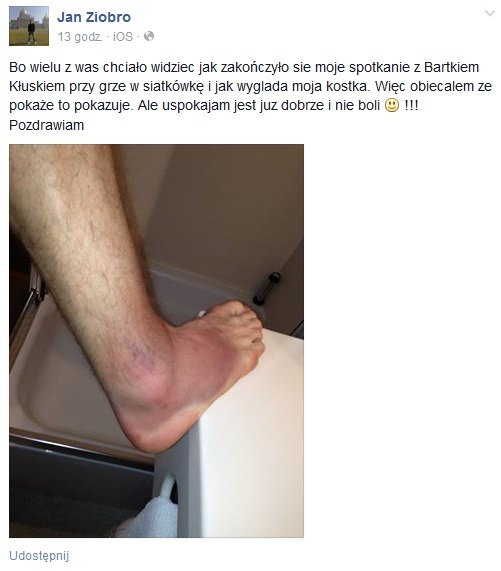 Jan Ziobro pokazał zdjęcie kontuzjowanej kostki /fot. screen Facebook