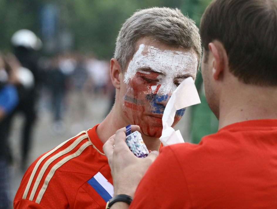 Rosyjski kibic opatrywany po marszu przed meczem Polska - Rosja na Euro 2012