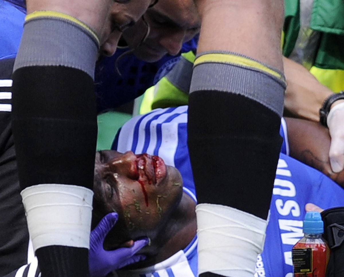 Didier Dorgba stracił przytomność podczas meczu z Norwich