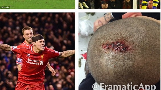 Martin Skrtel