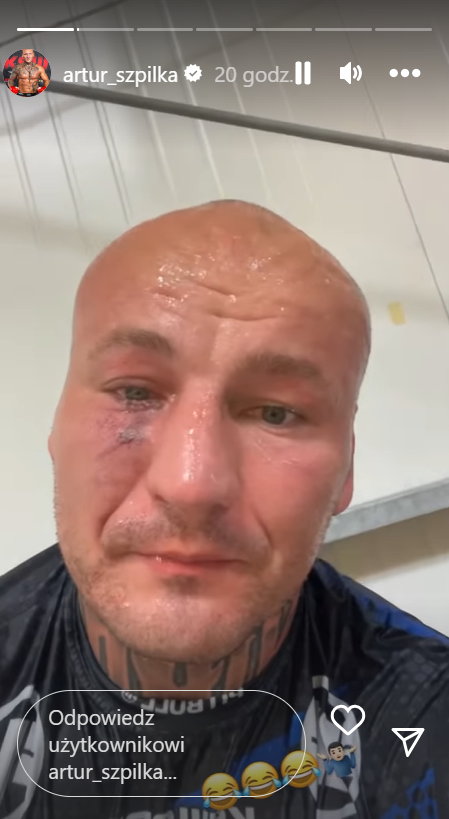 Artur Szpilka mocno oberwał podczas sparingu. W sieci pokazał nagranie