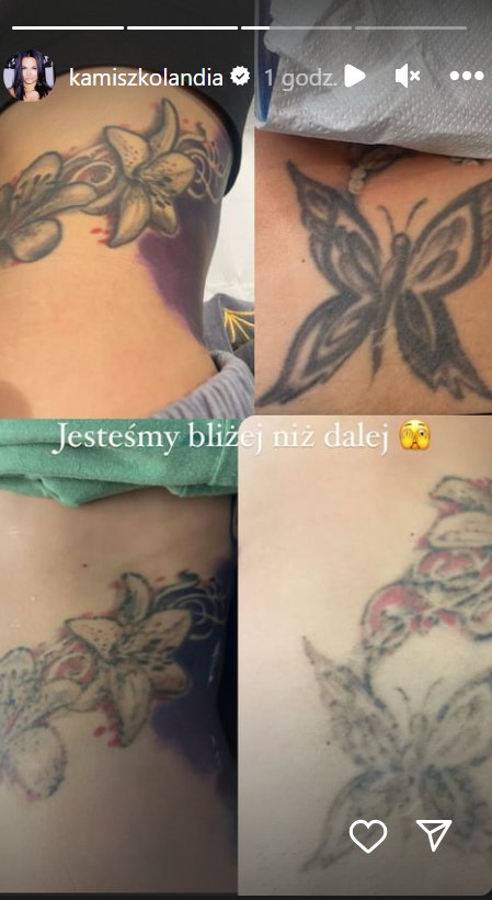 Kamila Wybrańczyk pokazała usuwany tatuaż