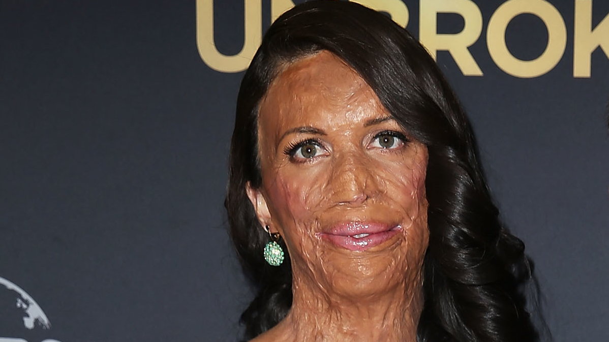 Turia Pitt