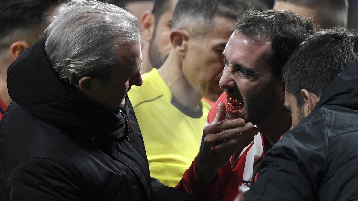 Diego Godin tuż po zderzeniu z bramkarzem Valencii