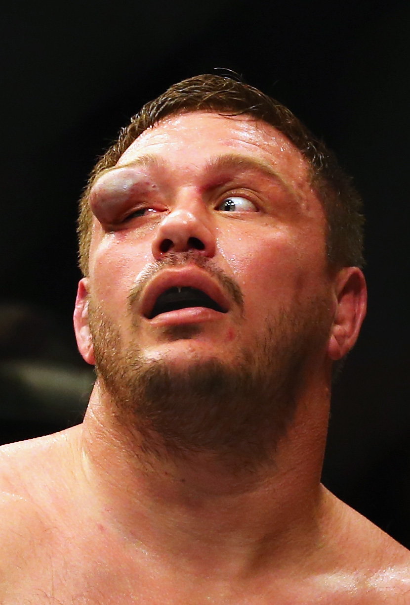 Matt Mitrione