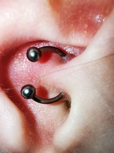 daith fülpiercing a fogyás érdekében