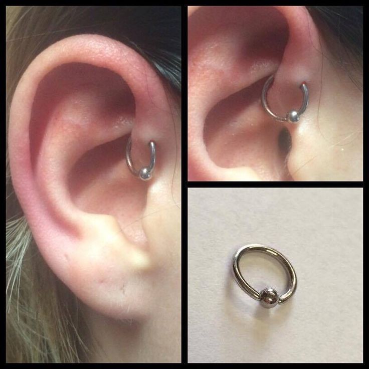 Forward Helix