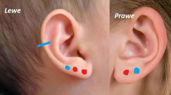 Jak przekonać rodziców na kolejne dziurki w uchu? :/ - Zapytaj.onet.pl -