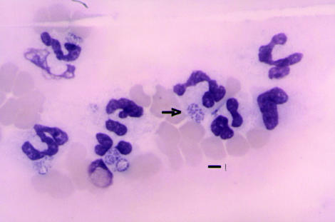 anaplazma1.bmp