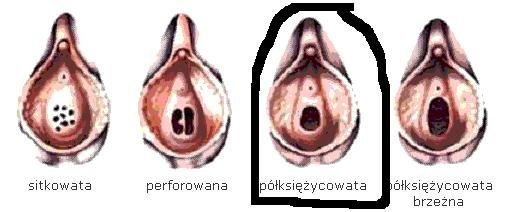 Blona Dziewicza Gdzie Dokladnie Sie Znajduje 57.